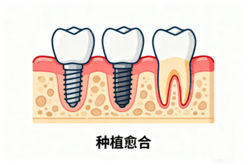 种植愈合卡通图.png