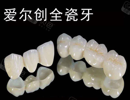 爱尔创全瓷牙实物图.jpg