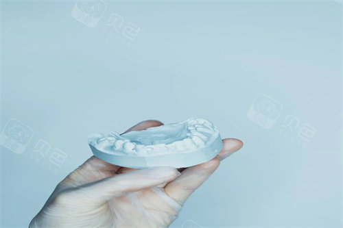 牙齿矫正模型展示.jpg