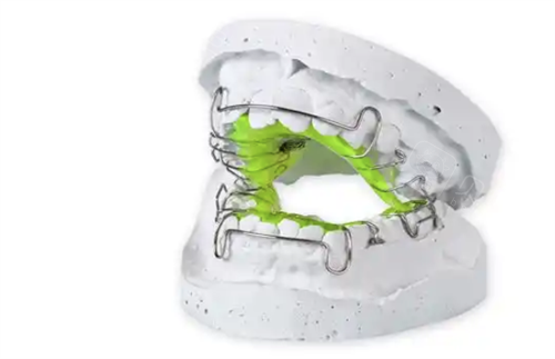 牙齿矫正扩弓器.png