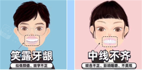需要矫正的牙齿图解.jpg