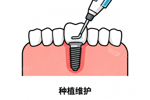 种植牙维护卡通图.png