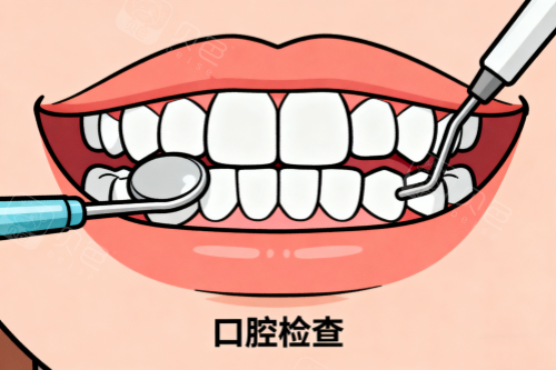 口腔检查卡通图.png
