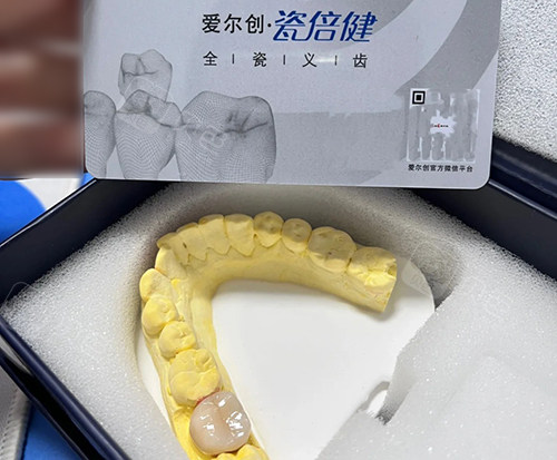 瓷倍健牙冠.jpg