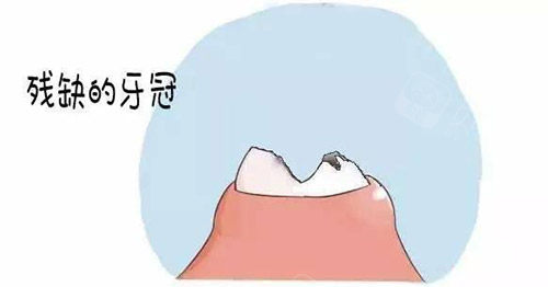 残根拔除照片.jpg