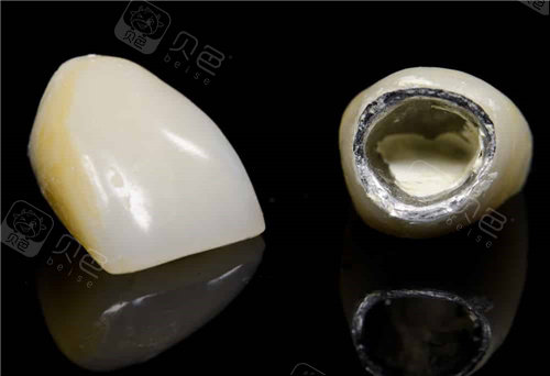 一颗烤瓷牙素材.jpg