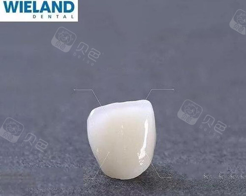 牙冠修复材料展示照片图.jpg