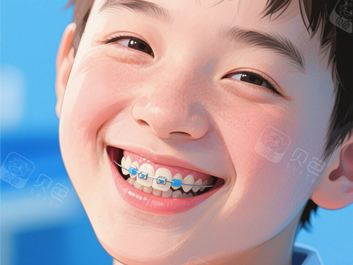 儿童金属托槽矫正.png