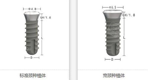 zdi种植体植牙如何.jpg