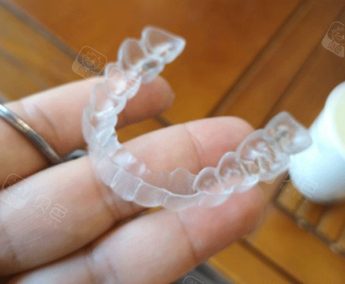 隐形牙齿矫正牙套图.png