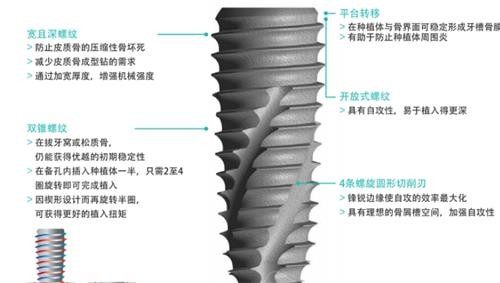 韩国柯威尔种植牙介绍.jpg